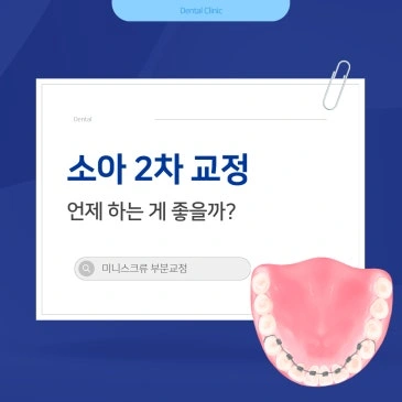 소아 2차 교정 언제 하는게 좋을까?